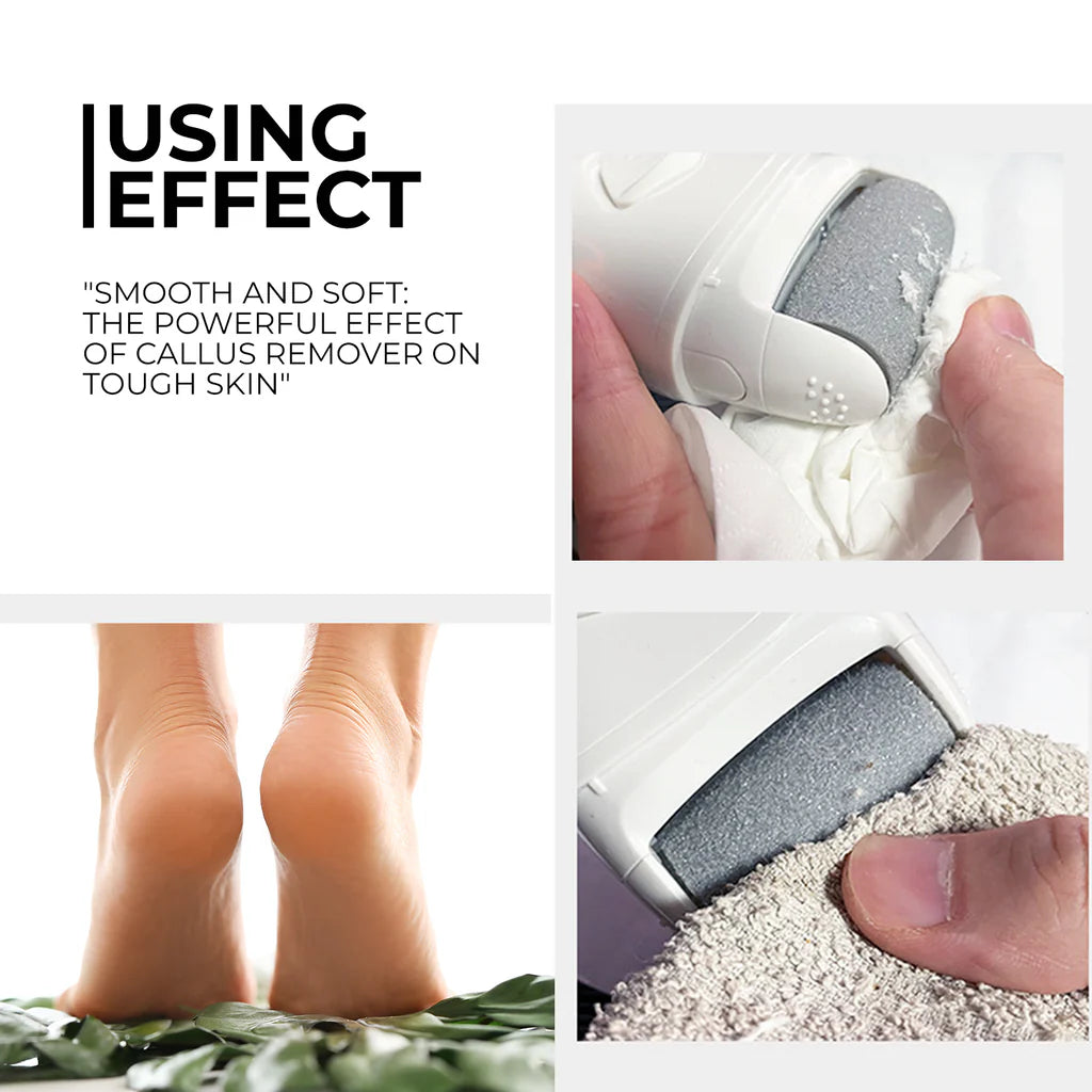 🦶✨Callus Electric Roller | 50% Off