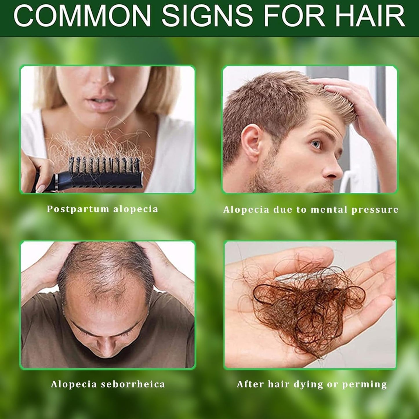 🌿 Rosemary Herbal Hair Growth Oil | FLAT 45% 🔥