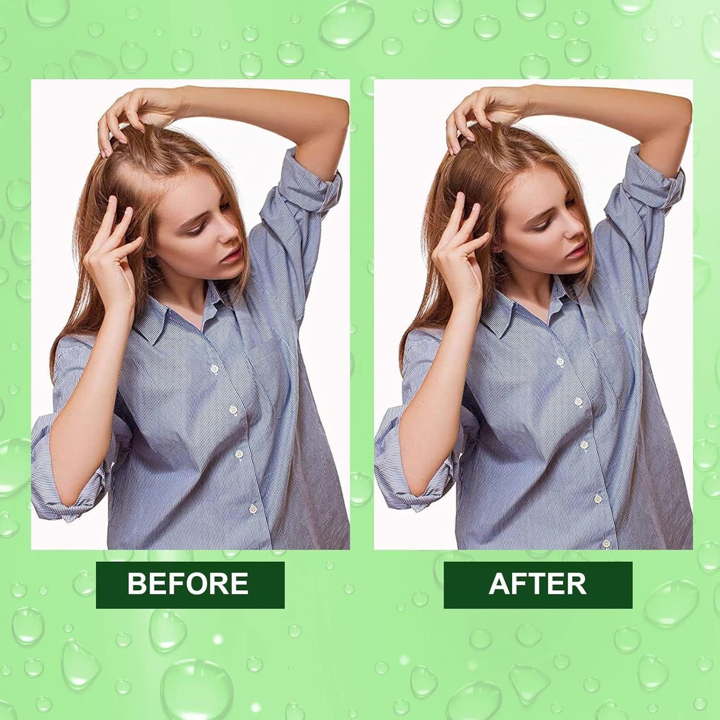 🌿 Rosemary Herbal Hair Growth Oil | FLAT 45% 🔥