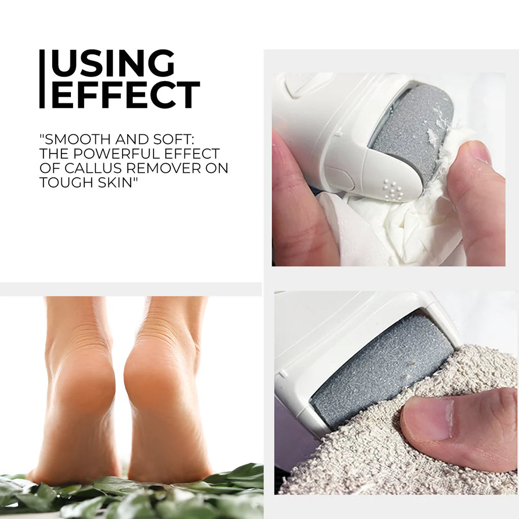 🦶✨Callus Electric Roller | 50% Off