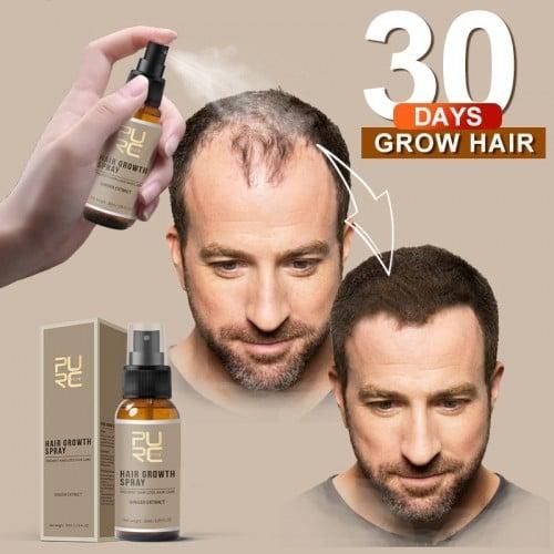 FAST GROW HAIR GROWTH SPRAY 🔥100% NATURAL ||| 15 DAYS COURCE ||| 100% RESULT🔥