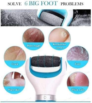 👣 Foot Care Genie Dead Skin Remover | FLAT 45%🔥