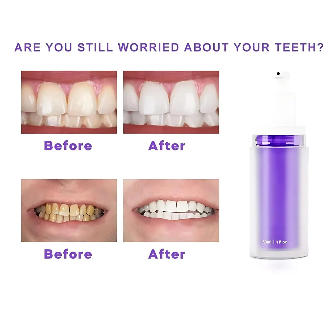 🦷 Whiten Wonder Purple Toothpaste | FLAT 50% 🔥