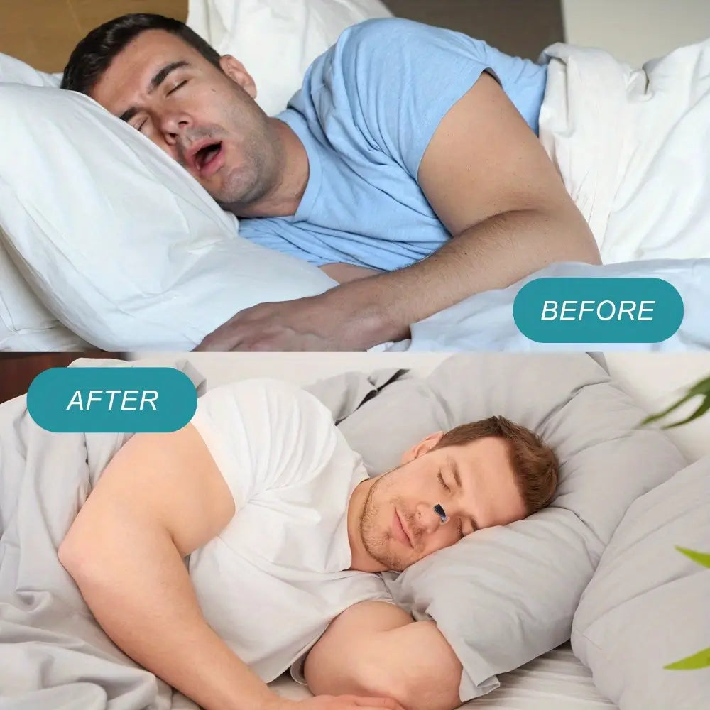💎 Magnetic Nasal Strips™ -  Breathe Better 💨🌙 | FLAT 45% Off 🔥